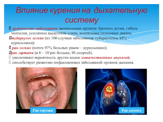 Влияние курения на дыхательную систему хронические заболевания дыхательных органов: бронхит,