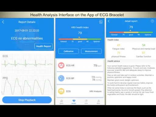 Health Analysis Interface on the App of ECG Bracelet