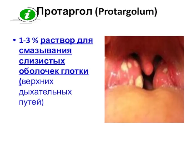 Протаргол (Protargolum) 1-3 % раствор для смазывания слизистых оболочек глотки (верхних дыхательных путей)