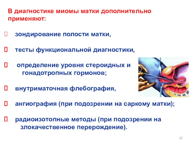 В диагностике миомы матки дополнительно применяют: зондирование полости матки, тесты