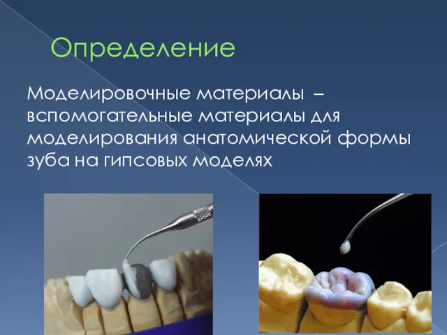 Определение Моделировочные материалы – вспомогательные материалы для моделирования анатомической формы зуба на гипсовых моделях