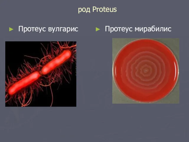 род Proteus Протеус вулгарис Протеус мирабилис