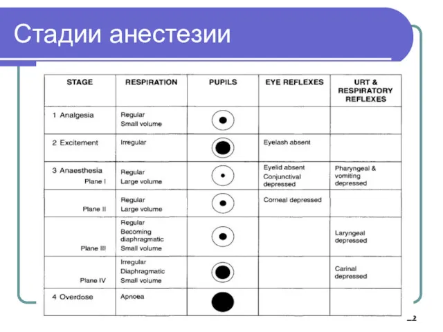 Стадии анестезии