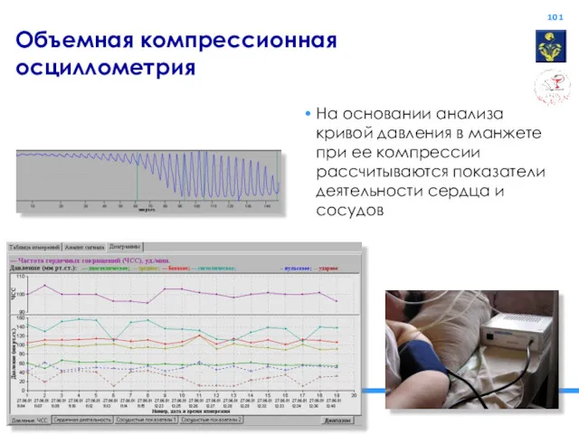 Объемная компрессионная осциллометрия На основании анализа кривой давления в манжете