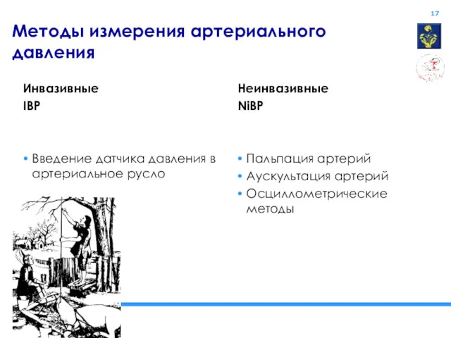 Методы измерения артериального давления Инвазивные IBP Введение датчика давления в