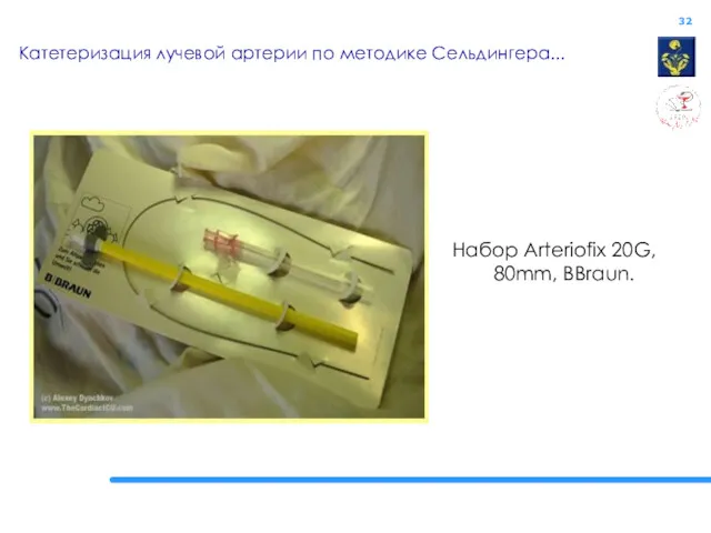 Катетеризация лучевой артерии по методике Сельдингера... Набор Arteriofix 20G, 80mm, BBraun.