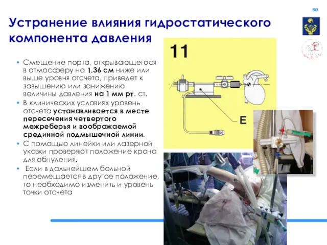 Устранение влияния гидростатического компонента давления Смещение порта, открывающегося в атмосферу