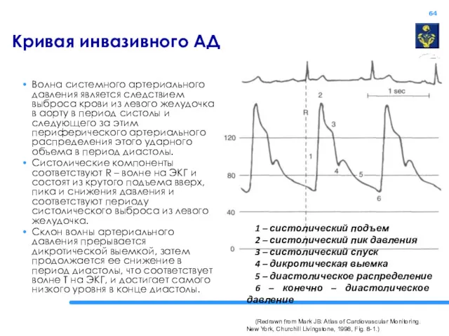 Кривая инвазивного АД Волна системного артериального давления является следствием выброса