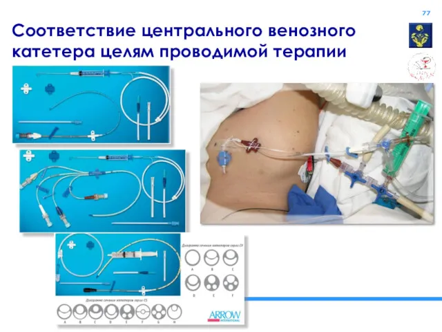 Соответствие центрального венозного катетера целям проводимой терапии