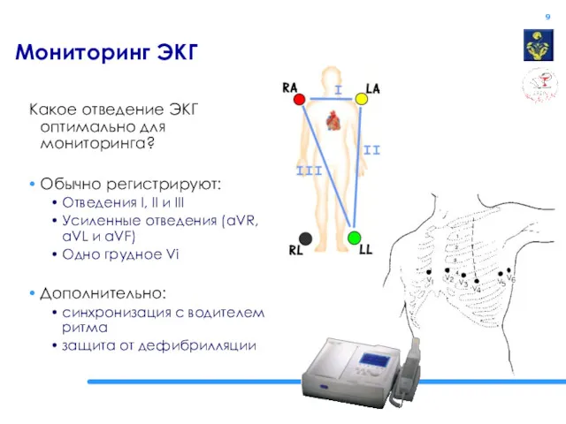 Мониторинг ЭКГ Какое отведение ЭКГ оптимально для мониторинга? Обычно регистрируют: