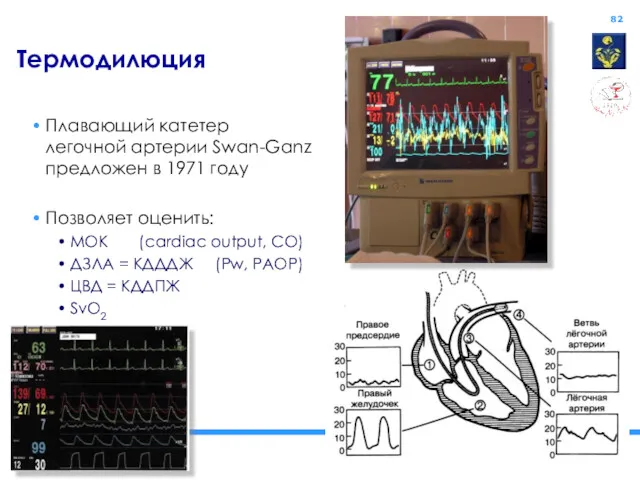 Термодилюция Плавающий катетер легочной артерии Swan-Ganz предложен в 1971 году