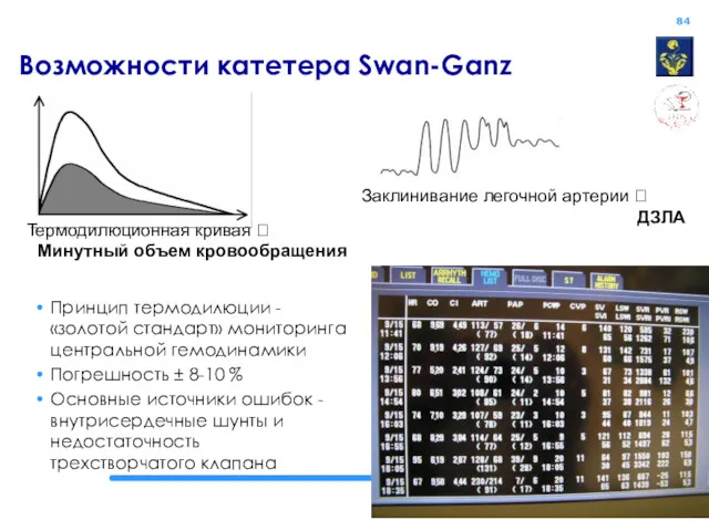 Возможности катетера Swan-Ganz Термодилюционная кривая ? Минутный объем кровообращения Заклинивание