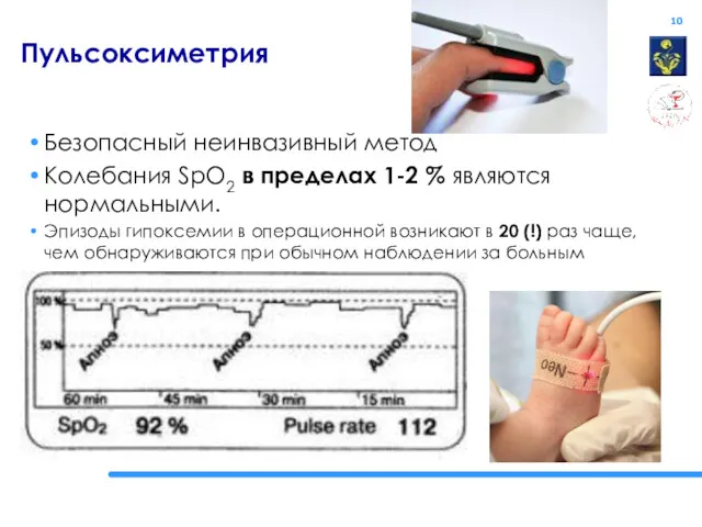 Пульсоксиметрия Безопасный неинвазивный метод Колебания SpO2 в пределах 1-2 %