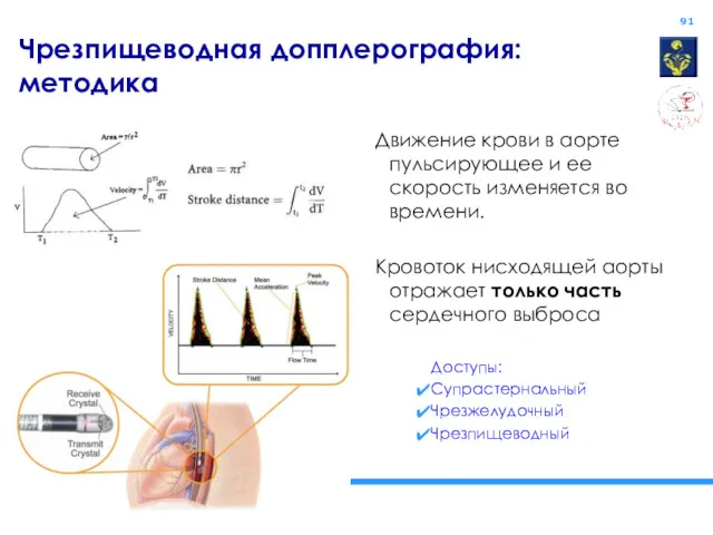 Чрезпищеводная допплерография: методика Движение крови в аорте пульсирующее и ее