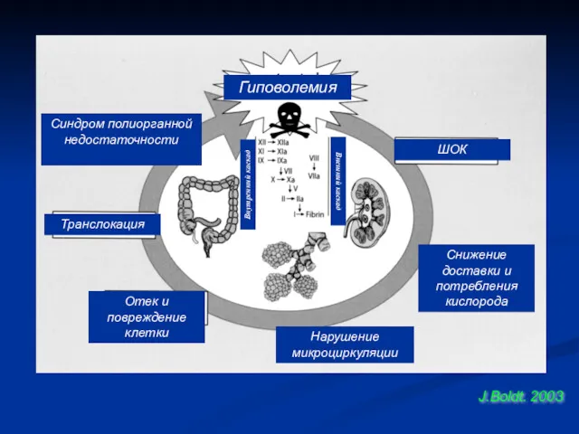 J.Boldt. 2003 Гиповолемия Синдром полиорганной недостаточности Транслокация Отек и повреждение