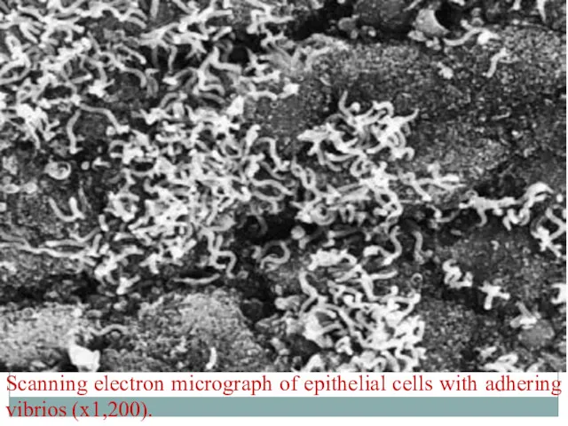 Scanning electron micrograph of epithelial cells with adhering vibrios (х1,200).