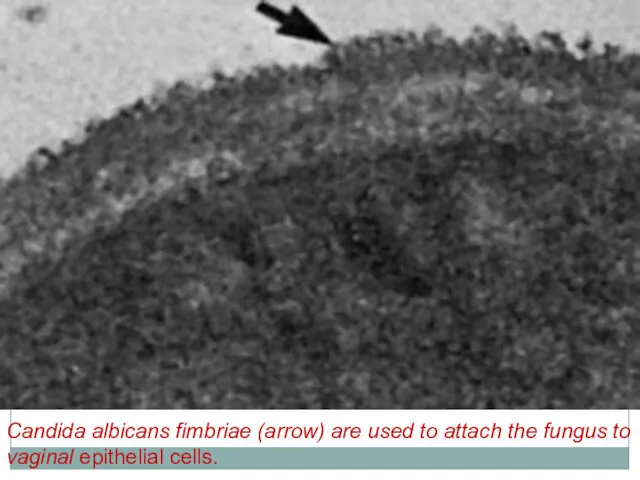 Candida albicans fimbriae (arrow) are used to attach the fungus to vaginal epithelial cells.