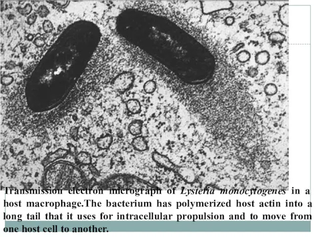 Transmission electron micrograph of Lysteria monocytogenes in a host macrophage.The