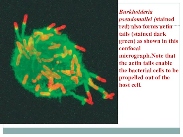 Burkholderia pseudomallei (stained red) also forms actin tails (stained dark