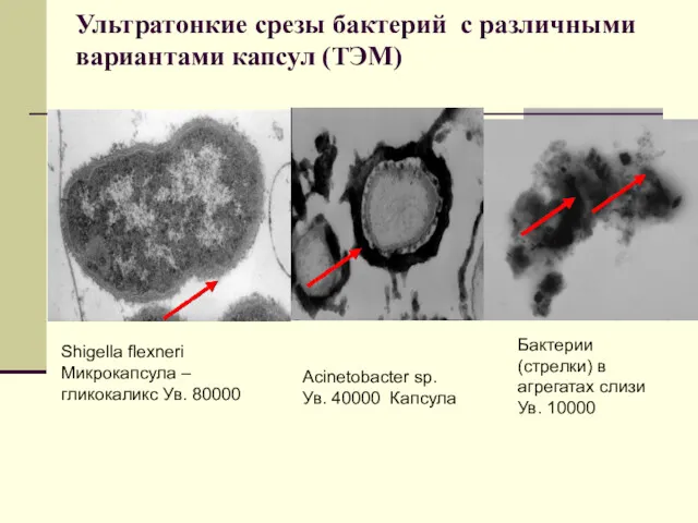 Ультратонкие срезы бактерий с различными вариантами капсул (ТЭМ) Shigella flexneri