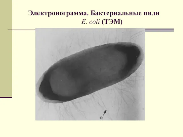 Электронограмма. Бактериальные пили E. coli (ТЭМ)