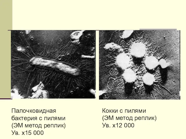 Палочковидная бактерия с пилями (ЭМ метод реплик) Ув. х15 000
