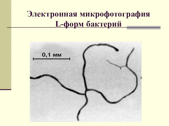 Электронная микрофотография L-форм бактерий