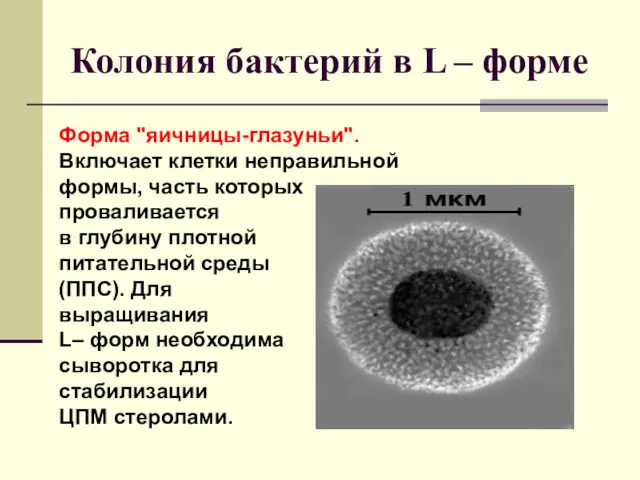 Колония бактерий в L – форме Форма "яичницы-глазуньи". Включает клетки