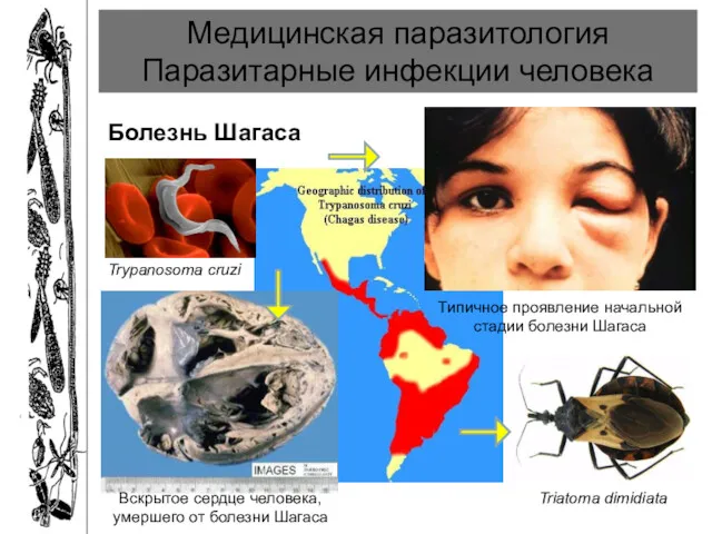 Медицинская паразитология Паразитарные инфекции человека Болезнь Шагаса Triatoma dimidiata Вскрытое
