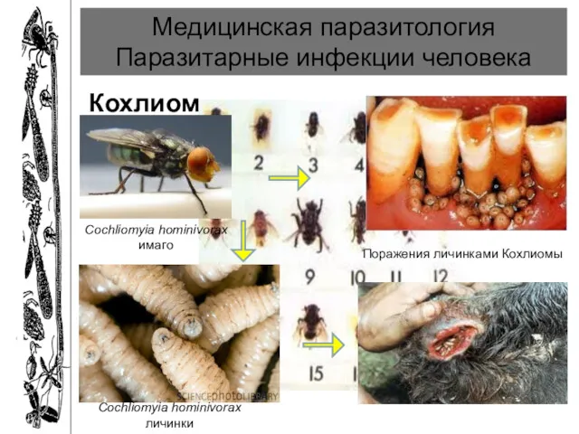 Медицинская паразитология Паразитарные инфекции человека Кохлиомиаз Cochliomyia hominivorax имаго Cochliomyia hominivorax личинки Поражения личинками Кохлиомы