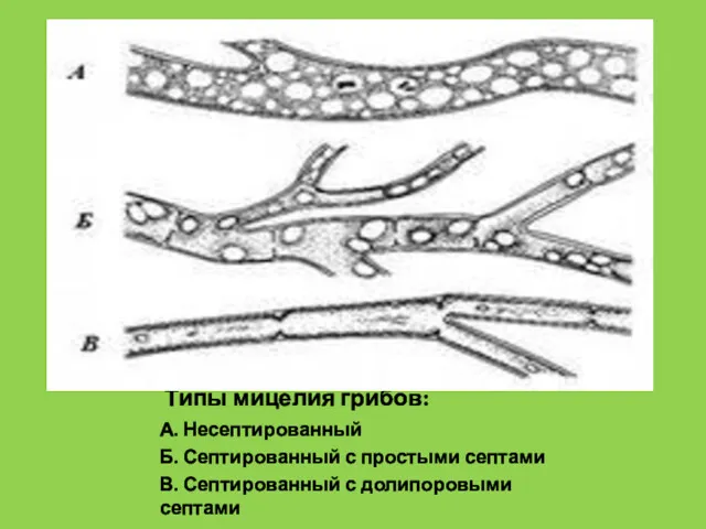 Типы мицелия грибов: А. Несептированный Б. Септированный с простыми септами В. Септированный с долипоровыми септами