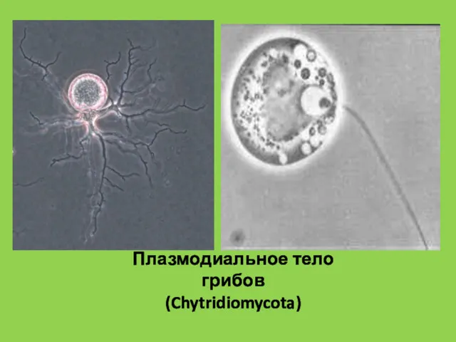 Плазмодиальное тело грибов (Chytridiomycota)