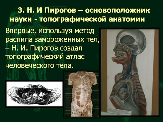3. Н. И Пирогов – основоположник науки - топографической анатомии