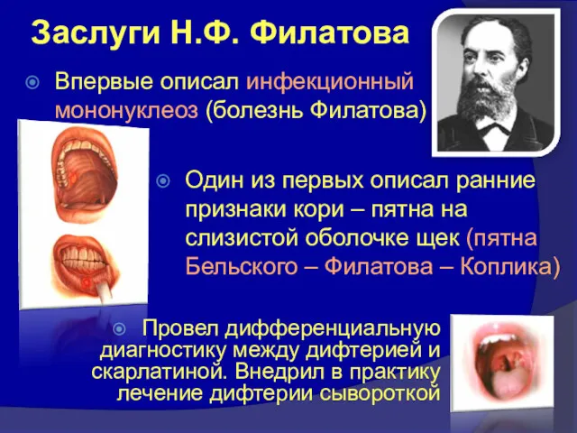 Заслуги Н.Ф. Филатова Провел дифференциальную диагностику между дифтерией и скарлатиной.