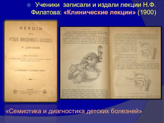Ученики записали и издали лекции Н.Ф.Филатова: «Клинические лекции» (1900) «Семиотика и диагностика детских болезней»