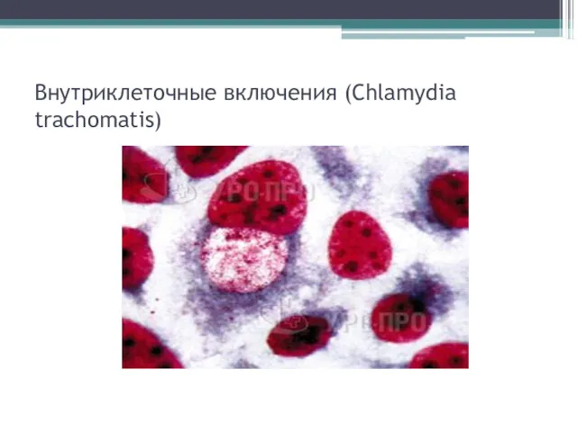 Внутриклеточные включения (Chlamydia trachomatis)