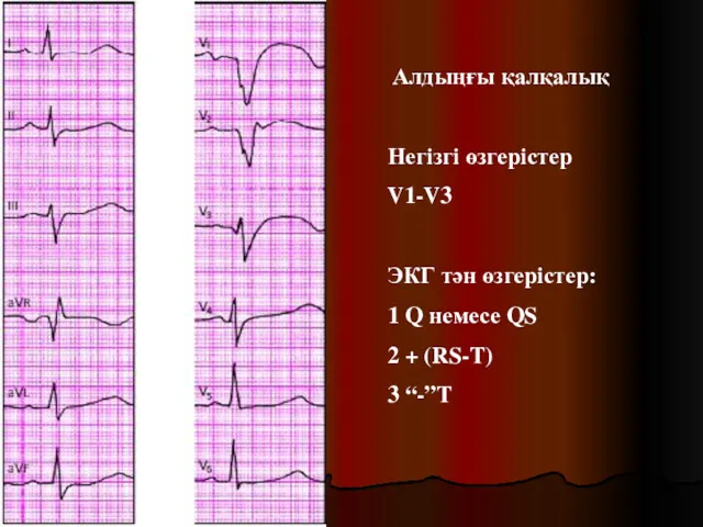 Алдыңғы қалқалық Негізгі өзгерістер V1-V3 ЭКГ тән өзгерістер: 1 Q немесе QS 2