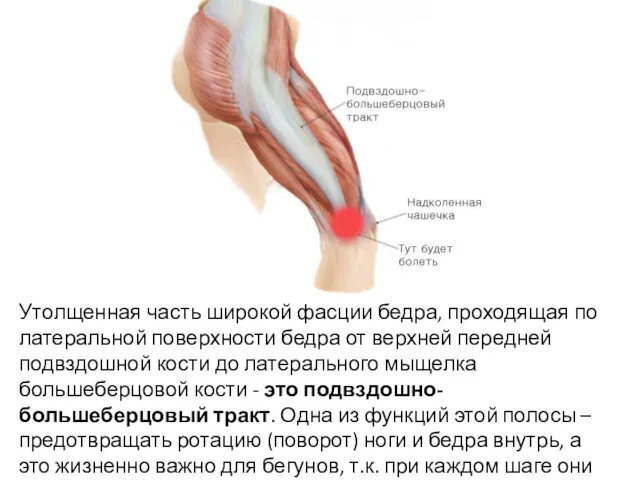 Утолщенная часть широкой фасции бедра, проходящая по латеральной поверхности бедра