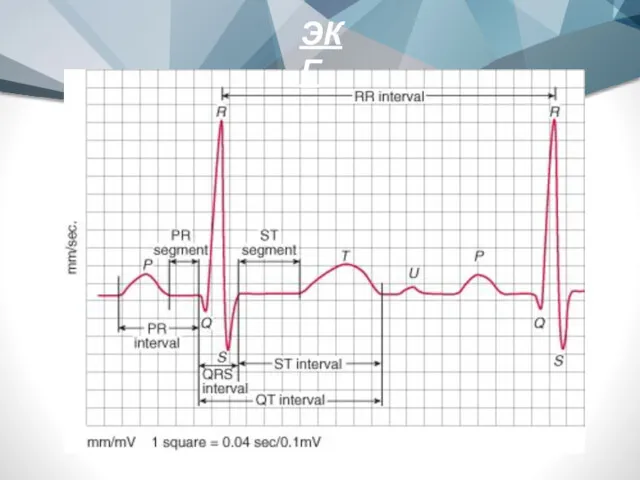 ЭКГ
