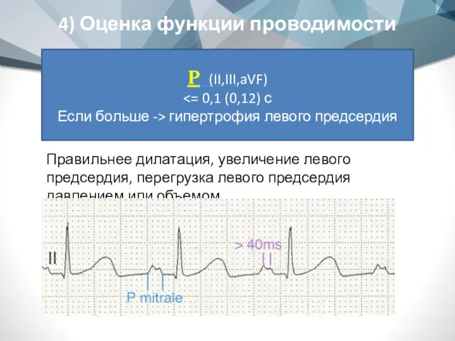 4) Оценка функции проводимости P (II,III,aVF) Если больше -> гипертрофия