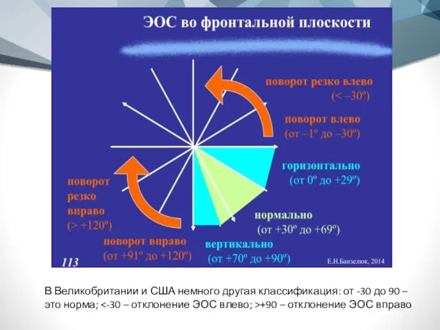 В Великобритании и США немного другая классификация: от -30 до