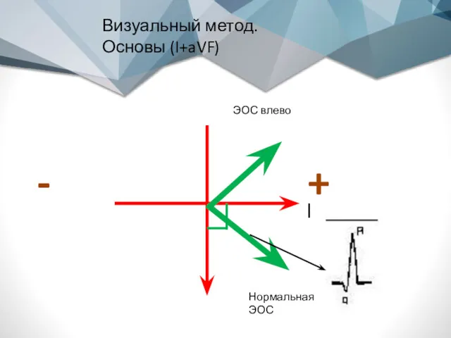 Визуальный метод. Основы (I+aVF) + I - ЭОС влево Нормальная ЭОС