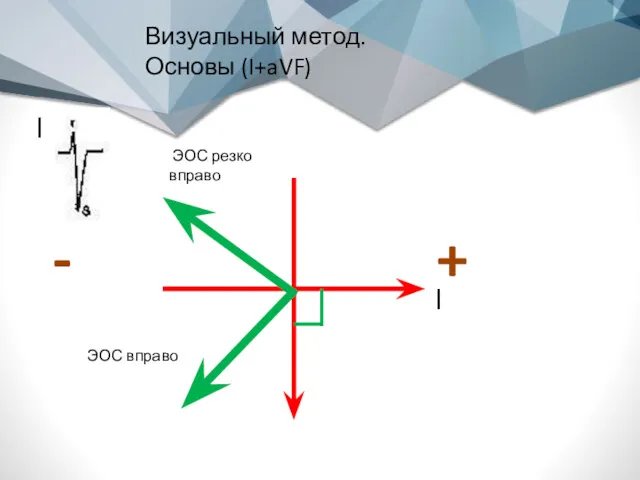 Визуальный метод. Основы (I+aVF) + I - ЭОС вправо I ЭОС резко вправо