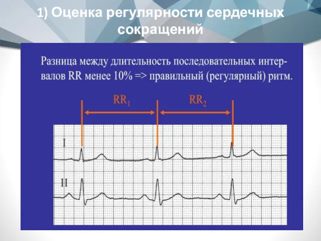 1) Оценка регулярности сердечных сокращений