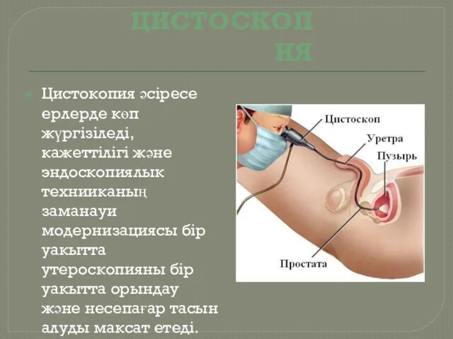 ЦИСТОСКОПИЯ Цистокопия әсіресе ерлерде көп жүргізіледі, кажеттілігі және эндоскопиялык технииканың