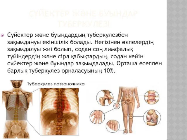 СҮЙЕКТЕР ЖӘНЕ БУЫНДАР ТУБЕРКУЛЕЗІ Сүйектер және буындардың туберкулезбен зақымдануы екіншілік болады. Негізінен өкпелердің