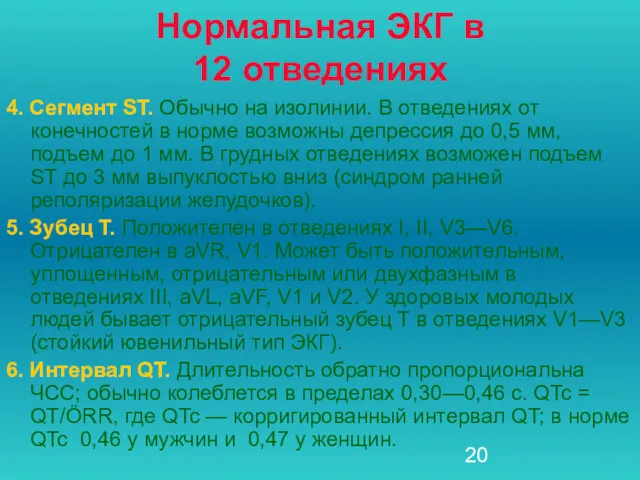 Нормальная ЭКГ в 12 отведениях 4. Сегмент ST. Обычно на