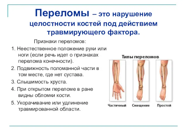Переломы – это нарушение целостности костей под действием травмирующего фактора. Признаки переломов: 1.
