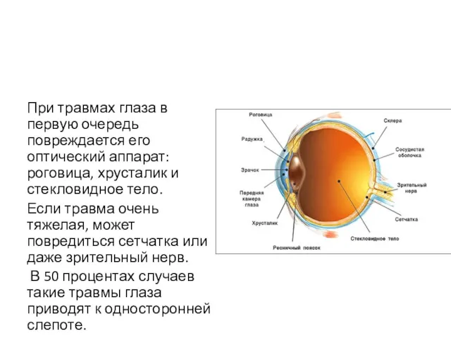 При травмах глаза в первую очередь повреждается его оптический аппарат: