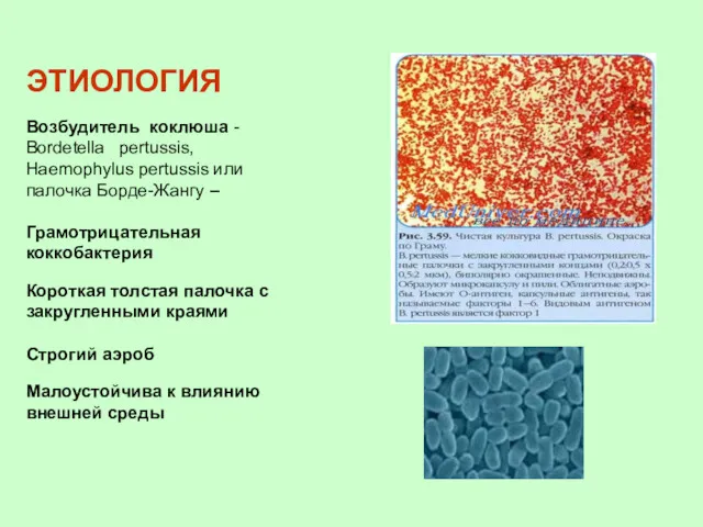 ЭТИОЛОГИЯ Возбудитель коклюша - Bordetella pertussis, Нaemophylus pertussis или палочка